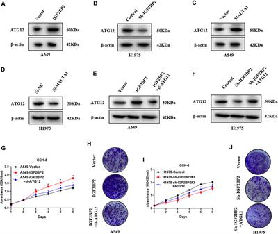 IGF2BP2 Regulates MALAT1 by Serving as an N6-Methyladenosine Reader to Promote NSCLC Proliferation